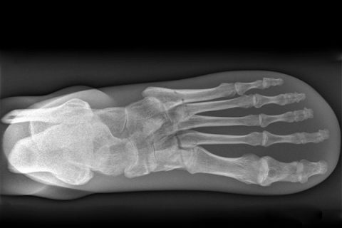 X RAY PHANTOM FOOT TRANSPARENT More Than Simulators