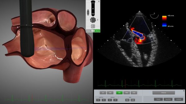 SIMULADOR PARA ECOCARDIOGRAFIA ETE Y ETT