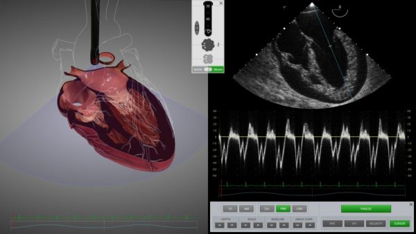 SIMULADOR PARA ECOCARDIOGRAFIA ETE Y ETT