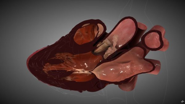 SIMULADOR PARA ECOCARDIOGRAFIA ETE Y ETT