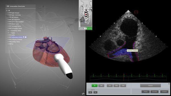 SIMULADOR PARA ECOCARDIOGRAFIA ETE Y ETT