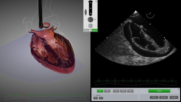 SIMULADOR PARA ECOCARDIOGRAFIA ETE Y ETT