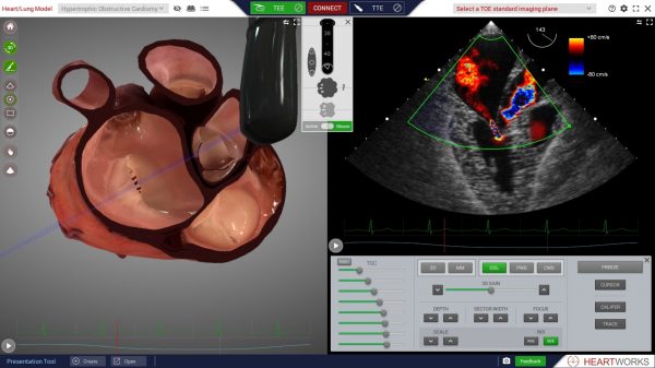 SIMULADOR PARA ECOCARDIOGRAFIA ETE Y ETT