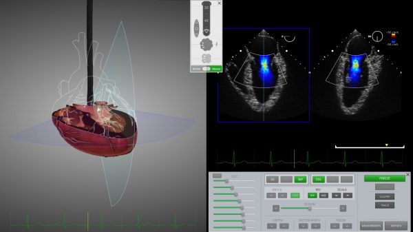SIMULADOR PARA ECOCARDIOGRAFIA ETE Y ETT