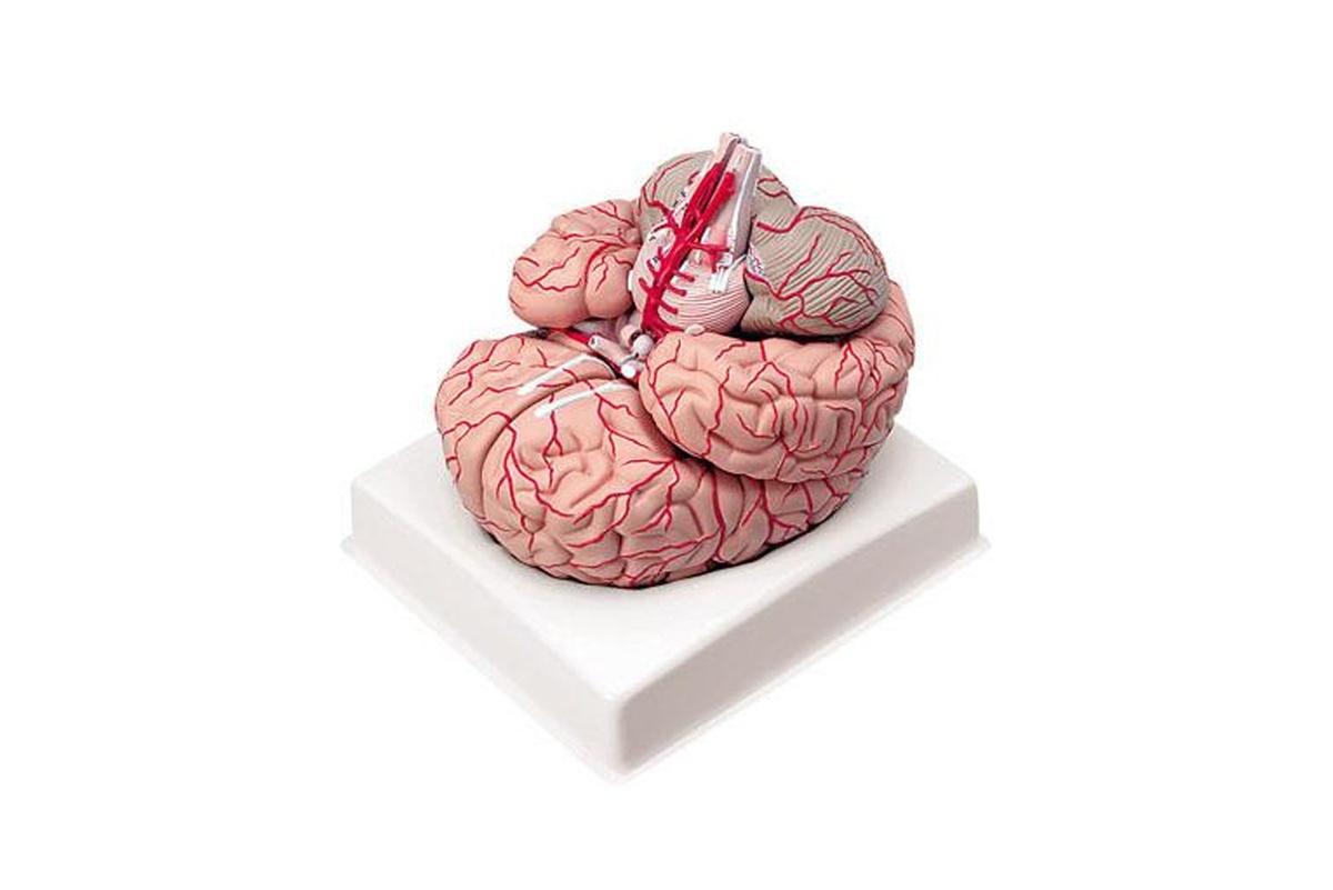 modelo de cerebro con arterias con 9 partes