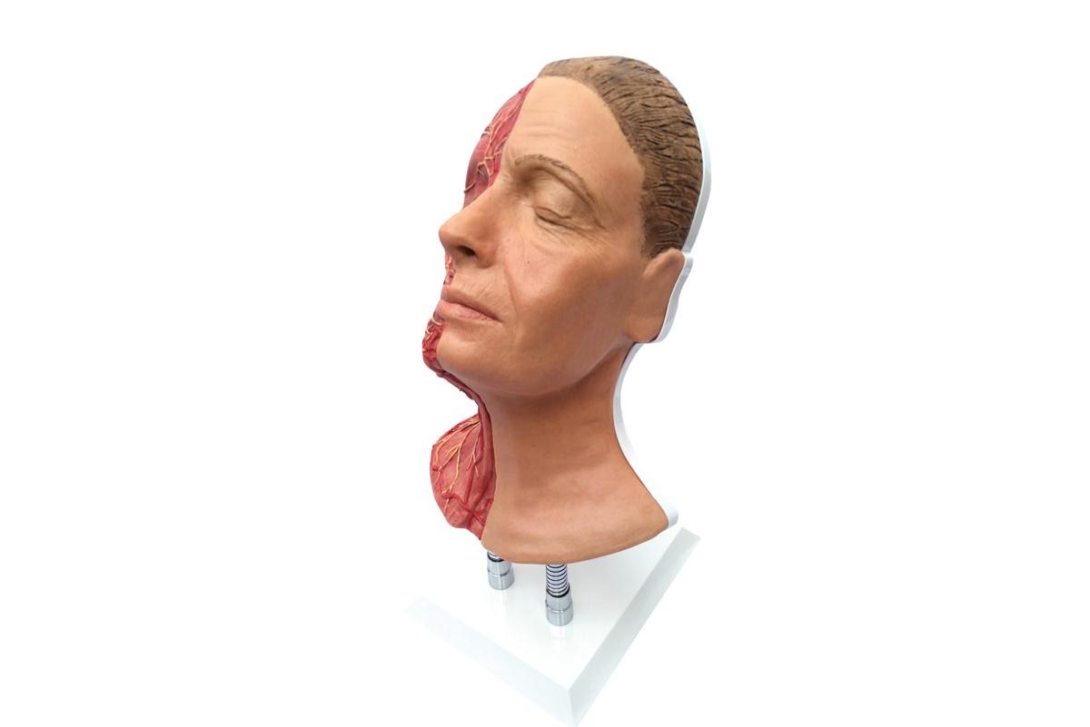 simulador para inyecciones faciales con arterias