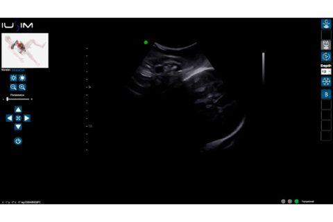 Intrapartum Ultrasound Simulator - IUSim | More Than Simulators
