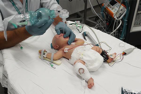 Simulador ultrarrealista neonato a término con displacía