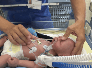 Simulador pulmonar neonatal