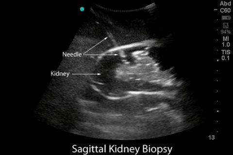 Renal biopsy simulator with ultrasound scanning | More Than Simulators